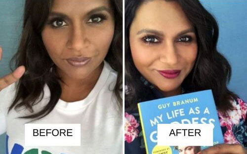 Mindy Kaling lip filler before and after