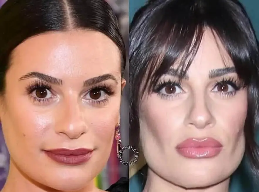 Lea Michele bichectomy before after