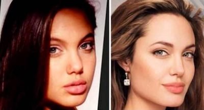 Angelina Jolie estetik öncesi sonrası