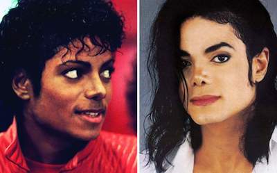 Michael Jackson estetik öncesi sonrasi