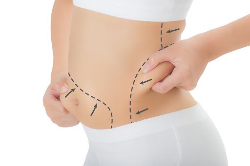 liposuction yöntemleri