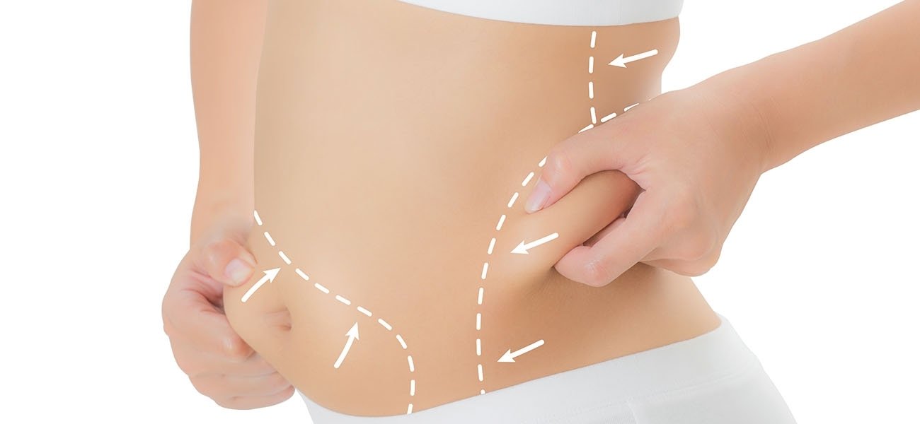 liposuction after pregnant