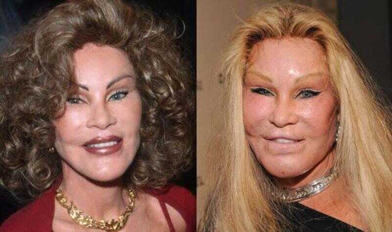 unnatural cosmetic surgery
