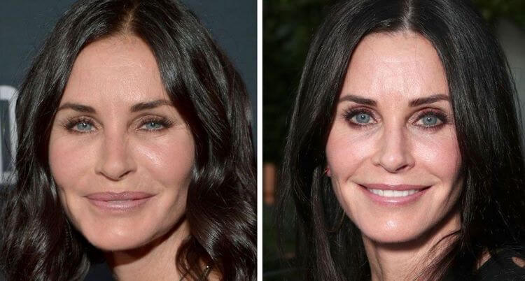 courteney cox overfilled