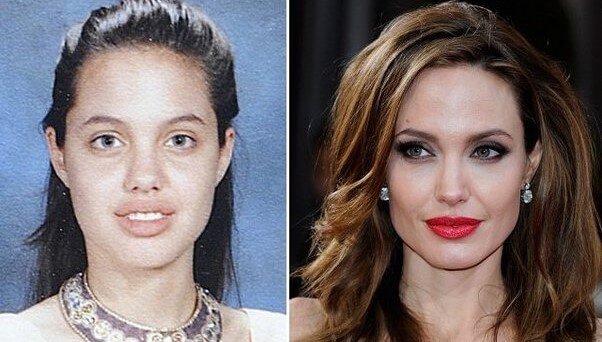 angelina jolie before after photo